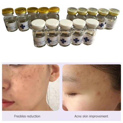 히아멜리 비 교차 결합 히알루론산 메소 테라피 용액 5Ml