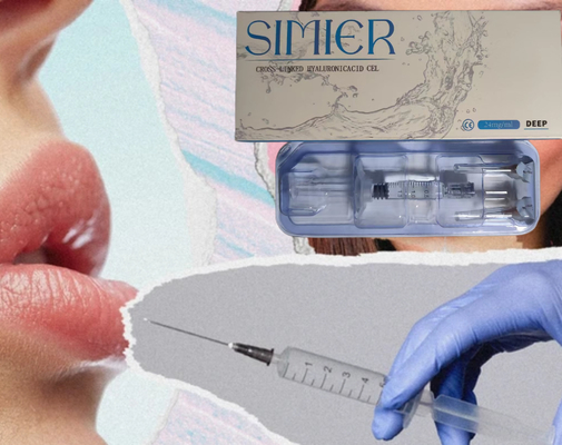 SIMIER 2ml 안티 윙크 얼굴 주입 히알루론산 피부 필러