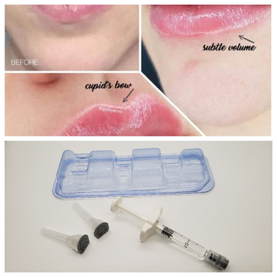 1ml Juvederm 의료 나트륨 히알루네이트 젤 히알루론산 젤 주입 코 다리