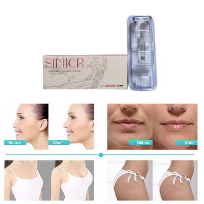 2ml 크로스 링크드 피부 필러 고 Ha 농도 24mg/ml Anti wrinkles
