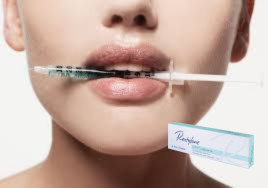 27g 마리온트 라인 히알루론산 채울기 1ml 리도와 함께 깊은 라인 채울기