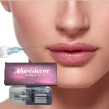 히알루론산 피부 필러 입술 주입 Juvederm Ultra3