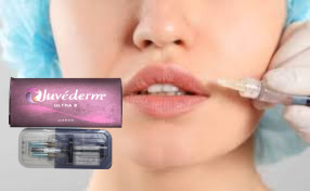 1ml / 박스 주입 가능한 입술 필러 턱 턱 턱 횡단 연결 된 HA 필러