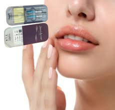 2 X 1ml Juvederm Ultra 4 주사용 피부 필러 입술 필러 주사