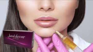 Juvederm Ultra 3 히알루론산 HA 피부 필러 2ml 입술 증강