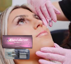 Juvederm Ultra 3 주사용 피부 필러 히알루론산 얼굴 주사 2*1ml