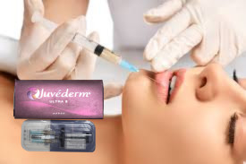 얼굴 코 히알루론산 립 필러 Juvederm Ultra 4 24mg/ml