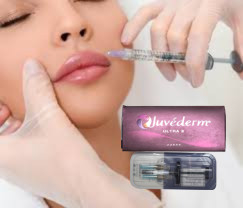 2 X 1ml Juvederm Ultra 4 주사용 피부 필러 입술 필러 주사