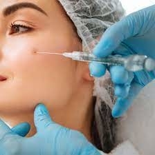 부드러운 주름 주입 피부 필러 히알루론산 주브더름 울트라 3 2*1ml